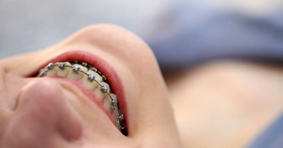 Osteopatia e Ortodonzia